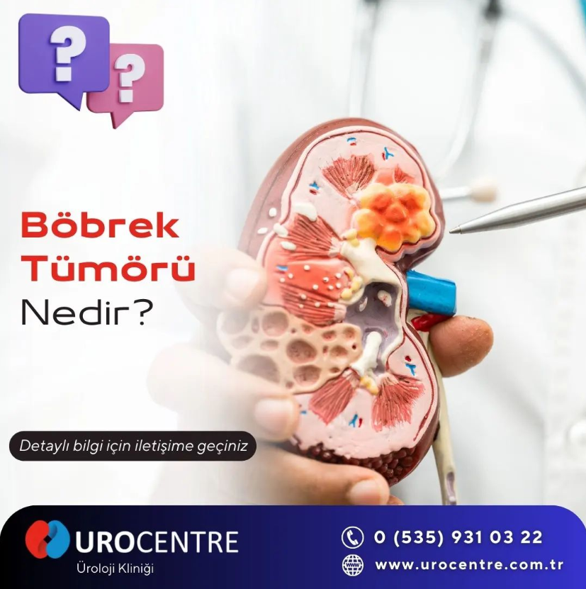 Böbrek Tümörleri