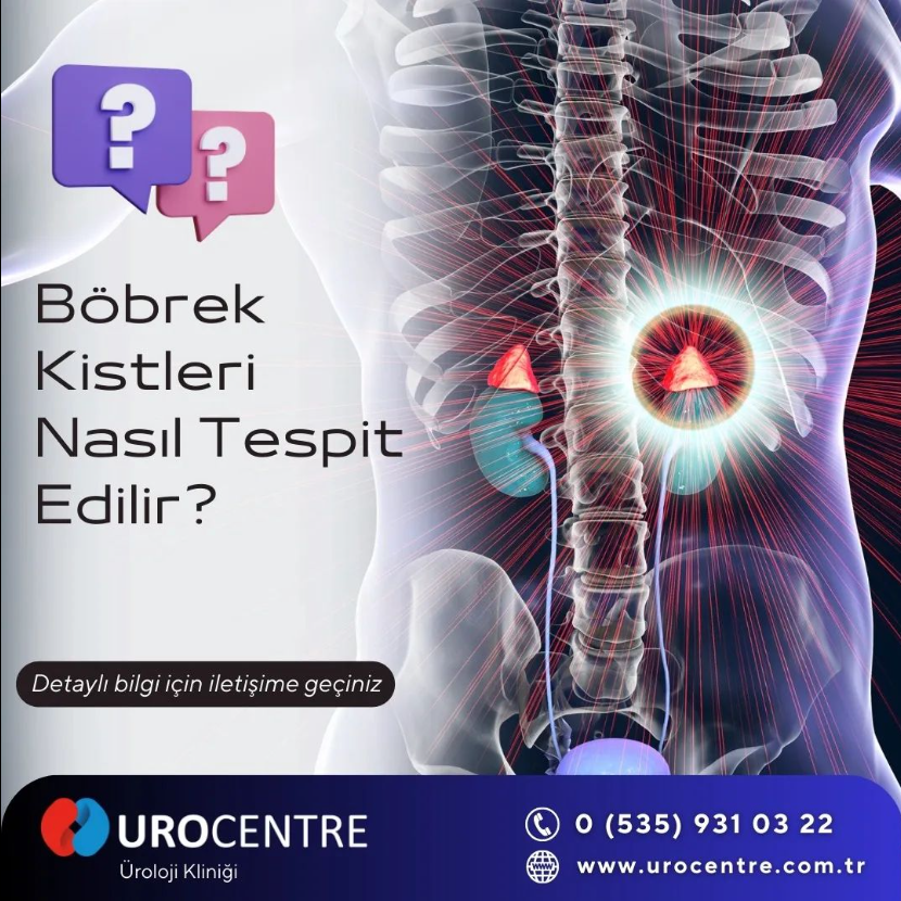 Böbrek Kistleri